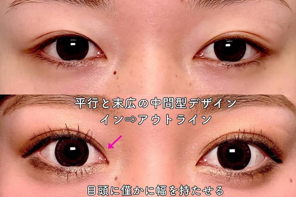 MIX型