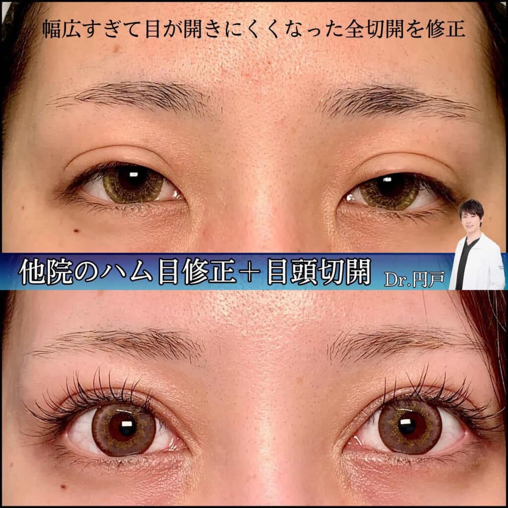 ハム目 他院修正