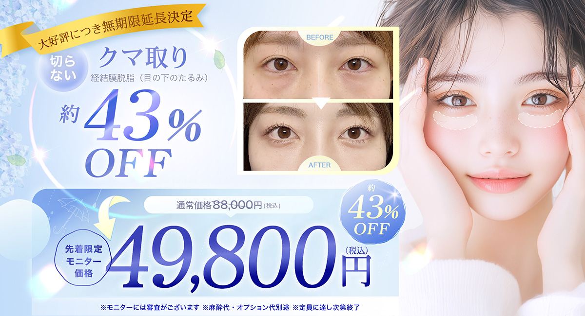 クマ取りの告知キャンペーンバナー