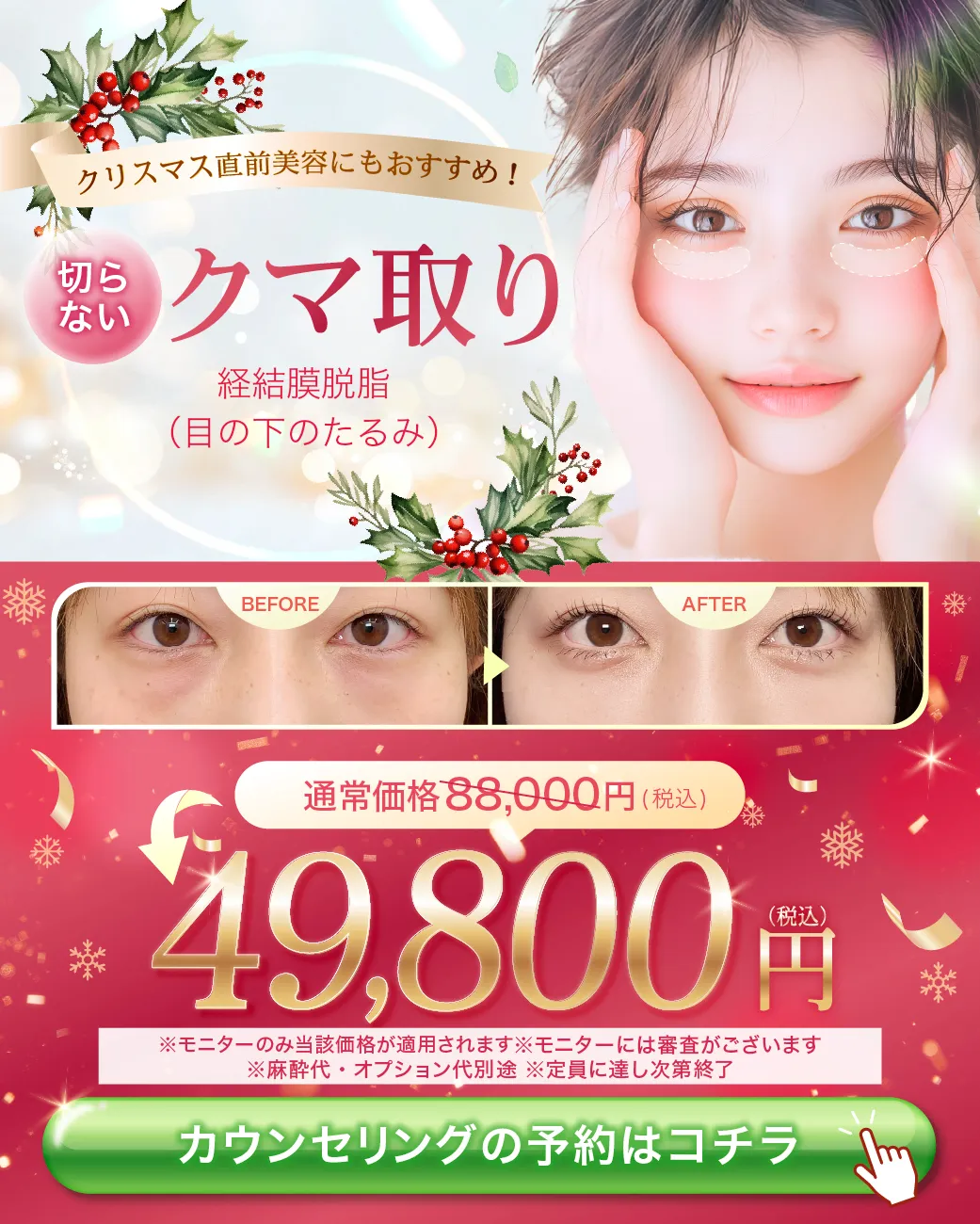 クマ取りの告知キャンペーンバナー