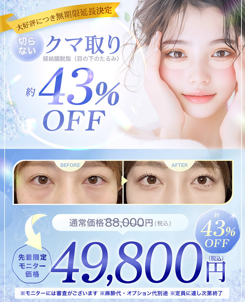 クマ取りの告知キャンペーンバナー