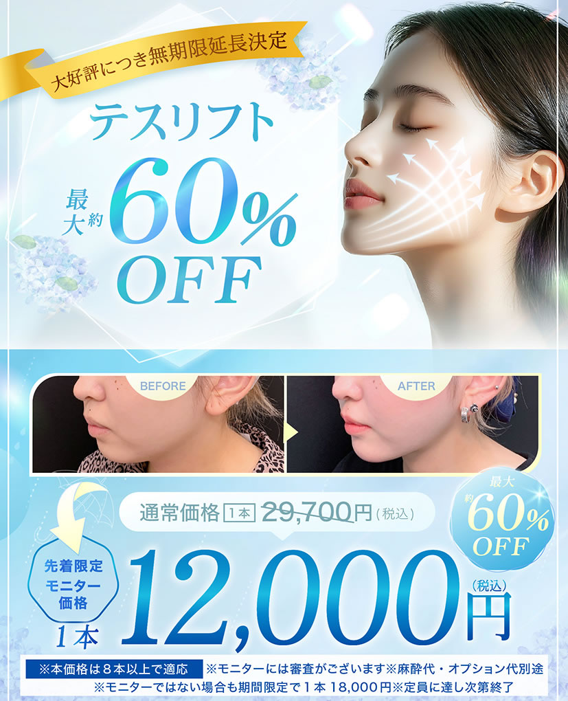 テスリフトの告知キャンペーンバナー