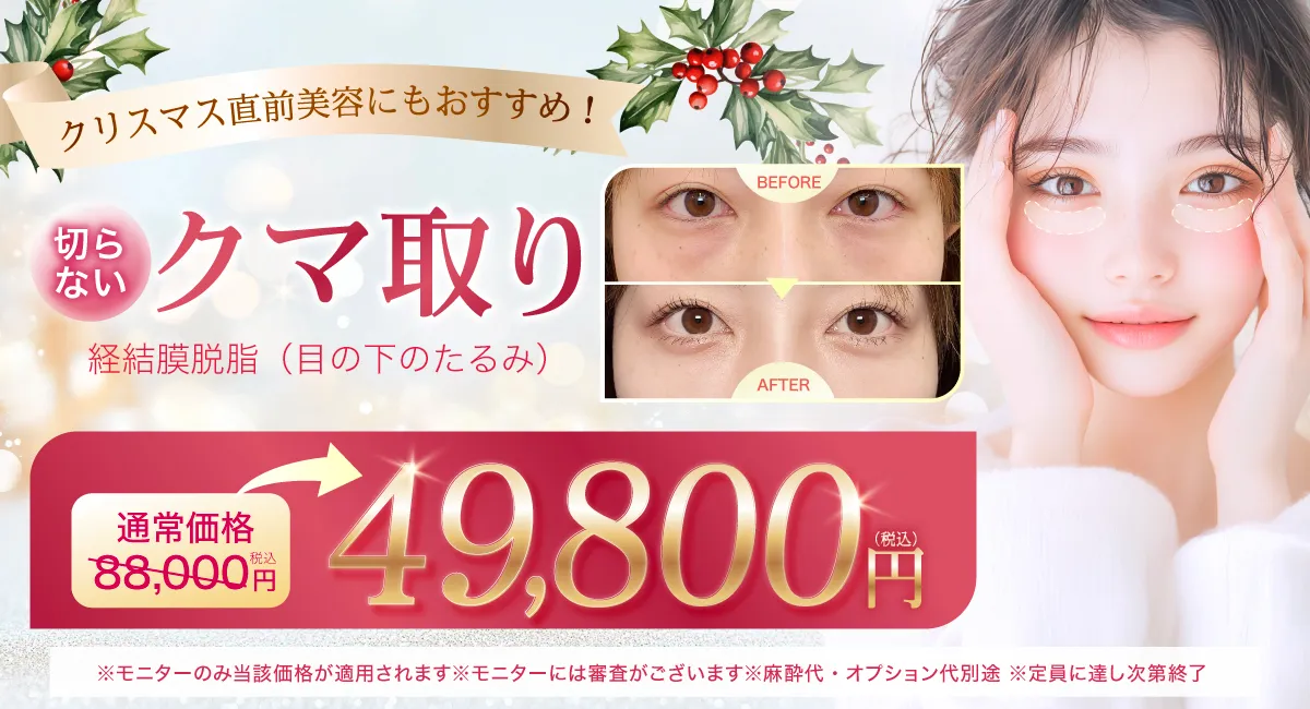 クマ取りの告知キャンペーンバナー