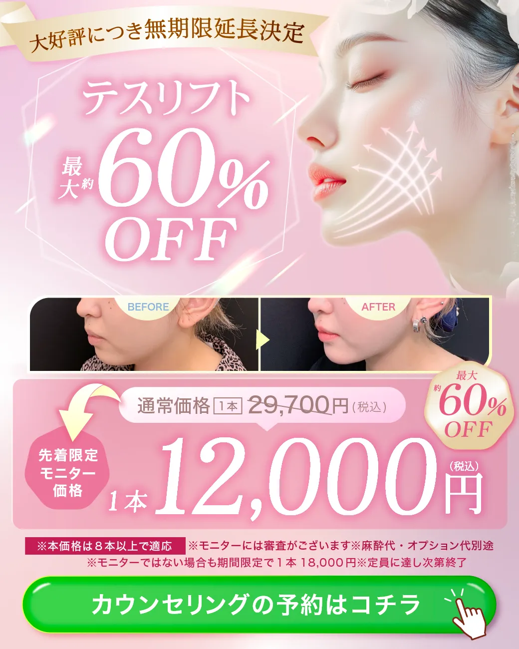 テスリフトの告知キャンペーンバナー