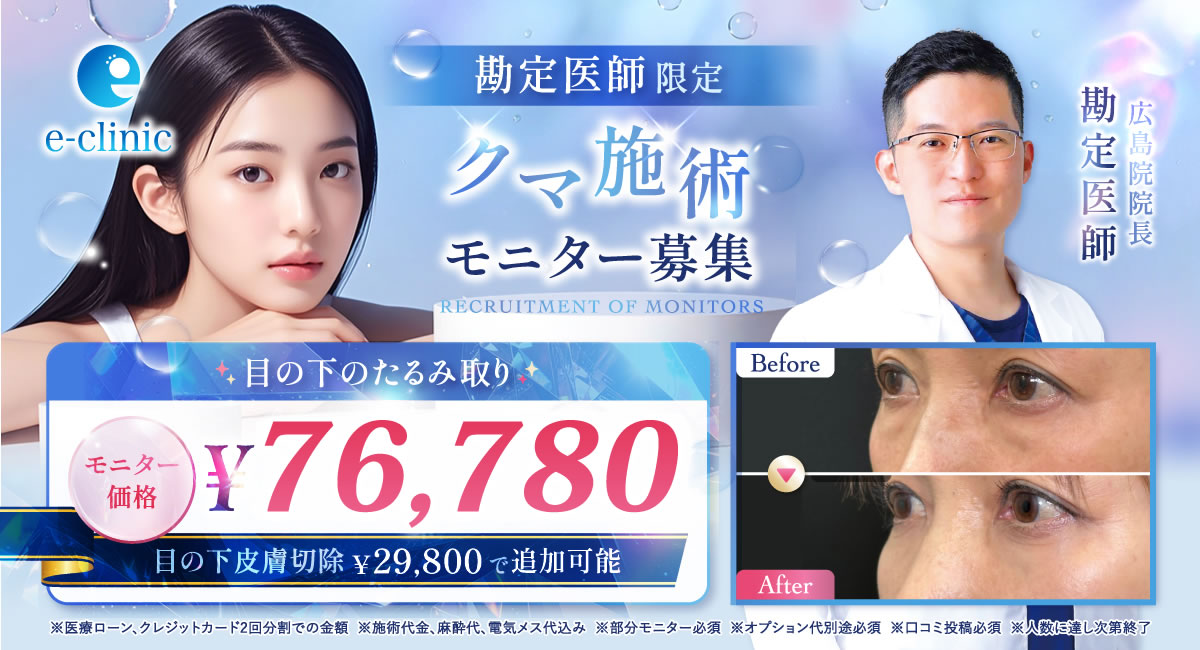 勘定医師のクマ取りのバナー