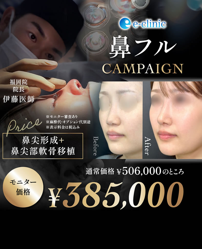 伊藤 渉医師の鼻フルキャンペーンバナー