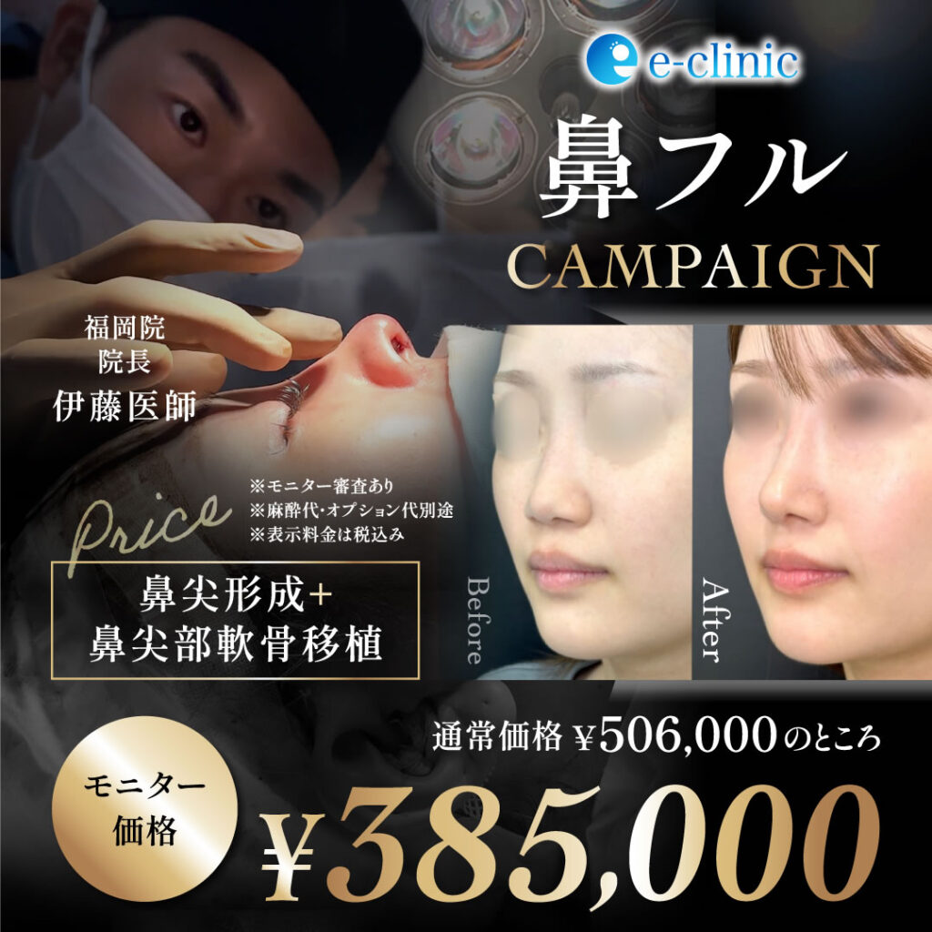伊藤 渉医師の鼻フルキャンペーンバナー (2)