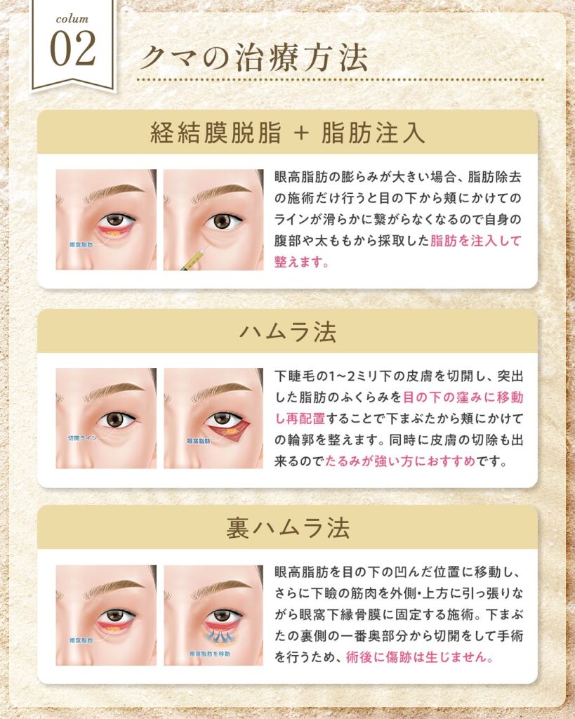 クマの手術方法の説明